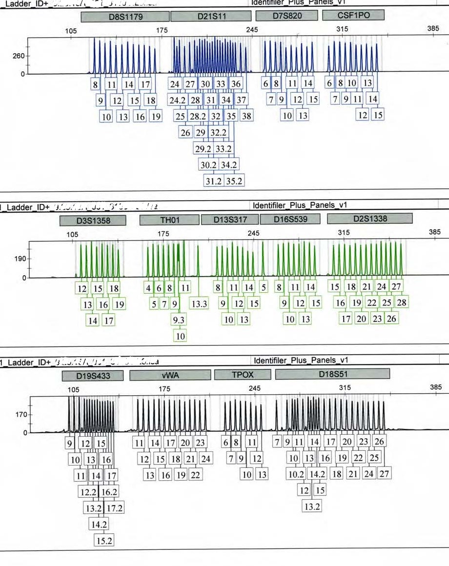 Forensic DNA electropherogram showing STR peaks used in DNA mixture interpretation